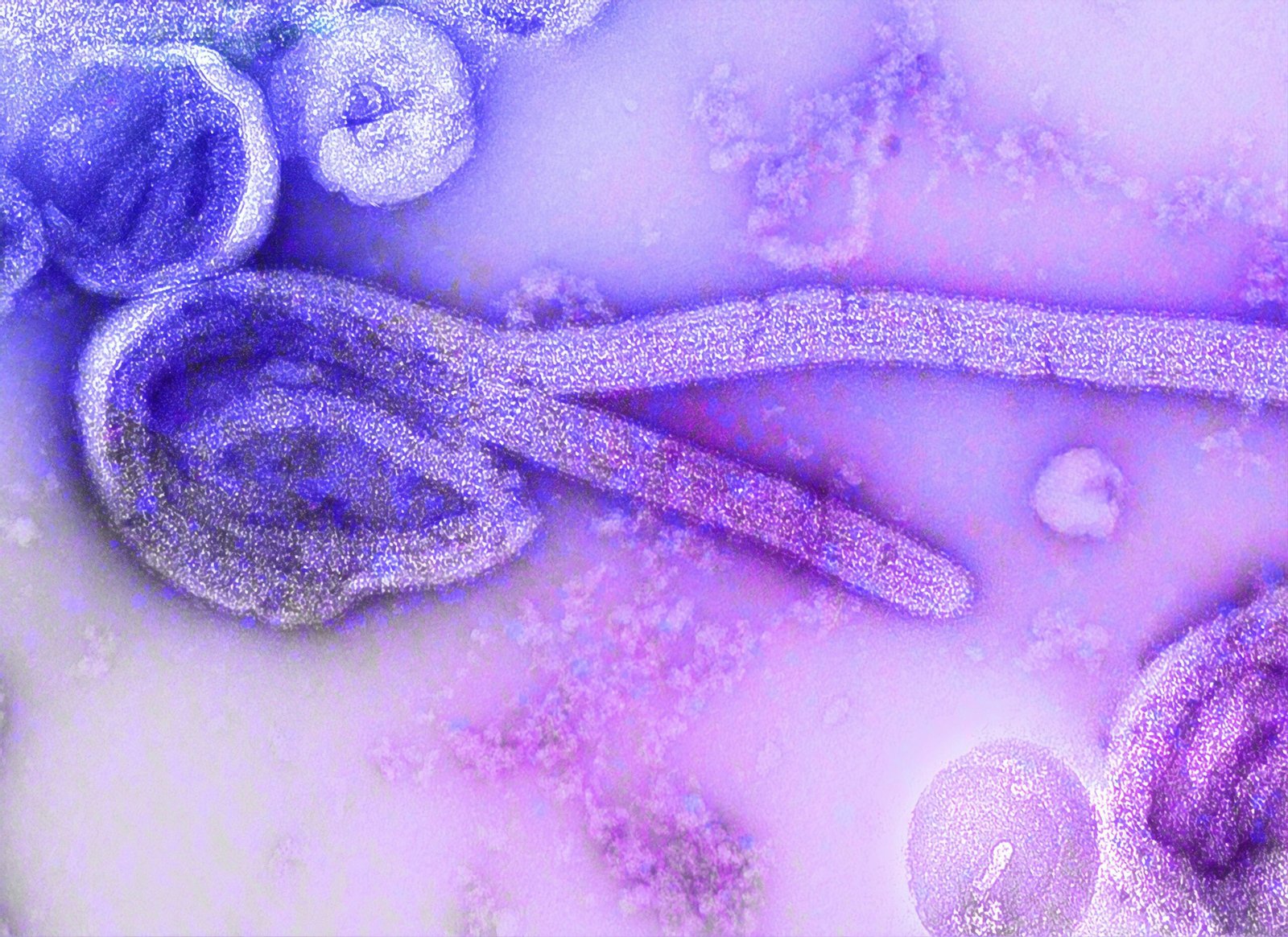 Ebola-Fälle in der DR Kongo