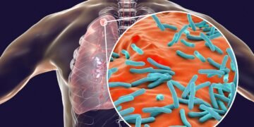 Tuberkulose-Erreger Entdeckung