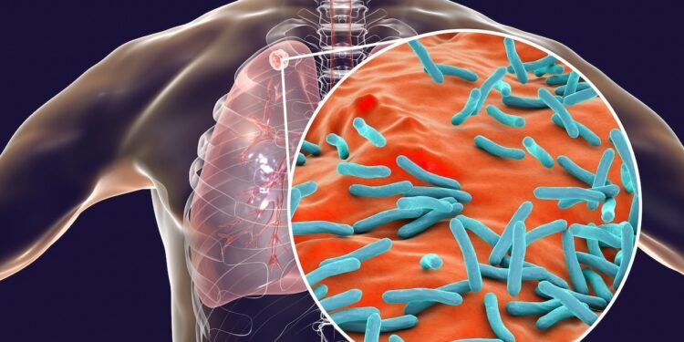 Tuberkulose-Erreger Entdeckung