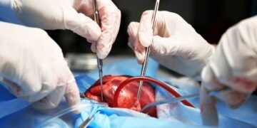 DDR-Arzt selbstgebaute Herz-Lungen-Maschine