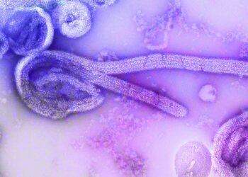 Ein isolierter Ebola-Patient wird an der Charité in Berlin behandelt