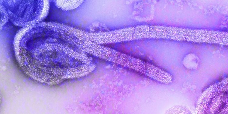 Familie von US Ebola Patienten in Berliner Isolierstation aufgenommen 26 Ein isolierter Ebola-Patient wird an der Charité in Berlin behandelt
