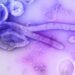 Ein isolierter Ebola-Patient wird an der Charité in Berlin behandelt