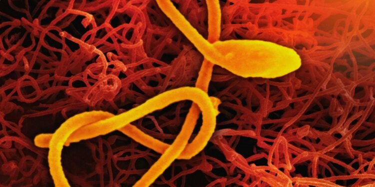 US-amerikanischer Ebola-Patient in Berliner Krankenhaus stabil, Familie negativ getestet 26 Ebola-Patient in Klinik in Berlin versorgt